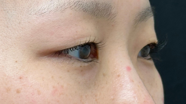 Preoperative Condition Part 1