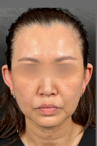 Preoperative Condition Part 1