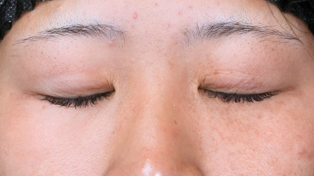 Preoperative Condition Part 1