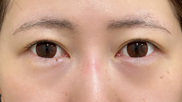 Preoperative Condition Part 1