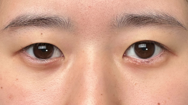 Preoperative Condition Part 1