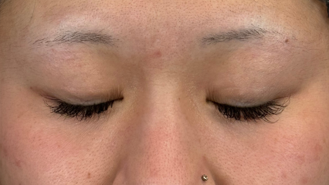 Preoperative Condition Part 1