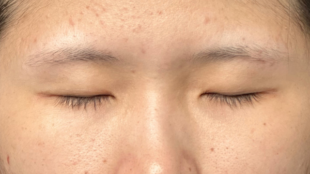 Preoperative Condition Part 1