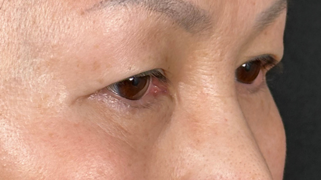 Preoperative Condition Part 1