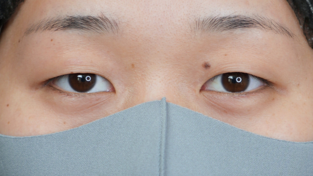 Preoperative Condition Part 1