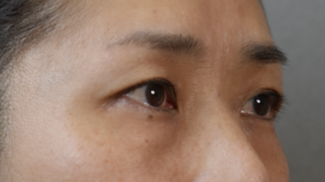 Preoperative Condition Part 1