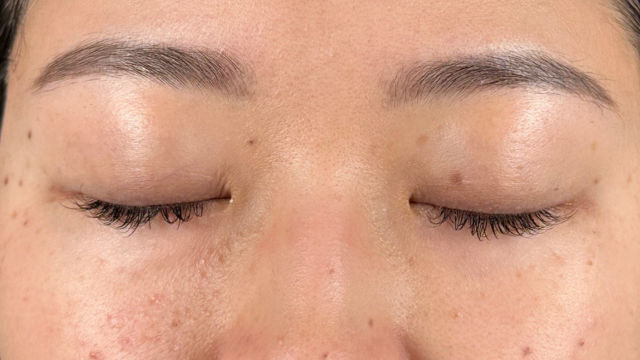 Preoperative Condition Part 1