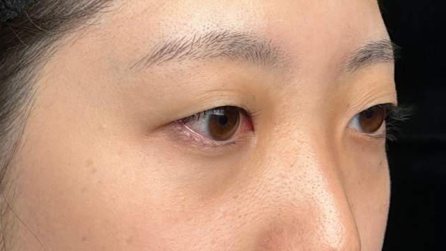 Preoperative Condition Part 1