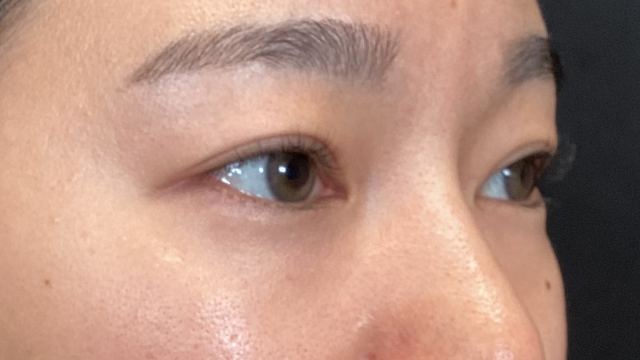 Preoperative Condition Part 1