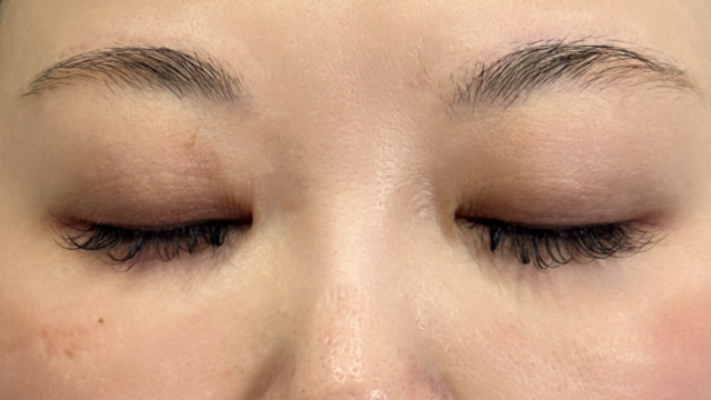 Preoperative Condition Part 1