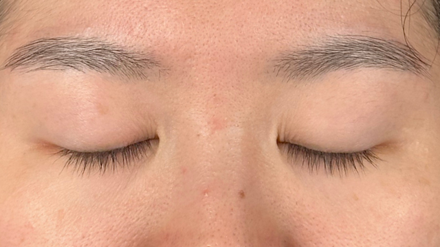 Preoperative Condition Part 1