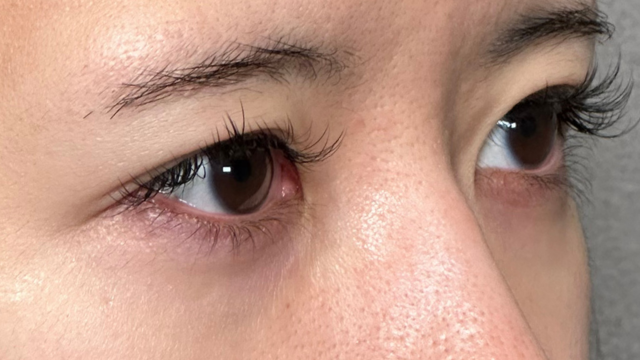 Preoperative Condition Part 1