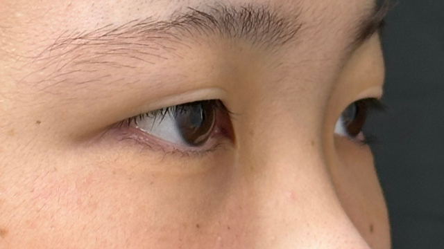 Preoperative Condition Part 1