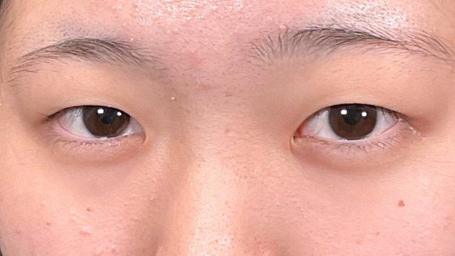 Preoperative Condition Part 1