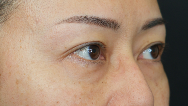 Preoperative Condition Part 1