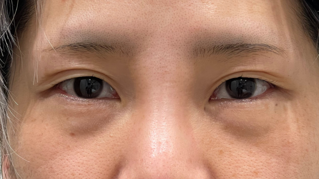 Preoperative Condition Part 1