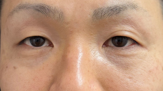 Preoperative Condition Part 1