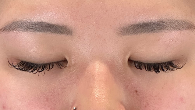 Preoperative Condition Part 1