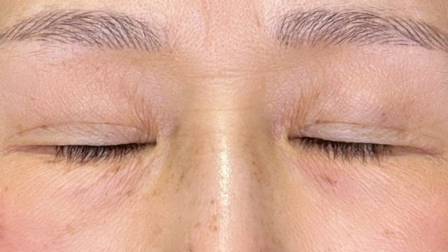 Preoperative Condition Part 1