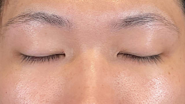 Preoperative Condition Part 1