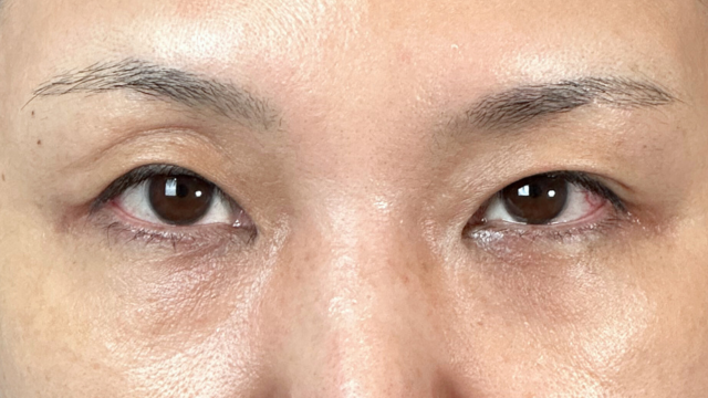 Preoperative Condition Part 1