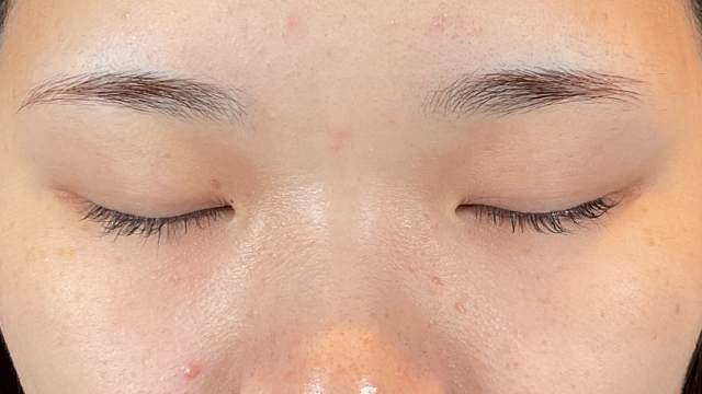 Preoperative Condition Part 1