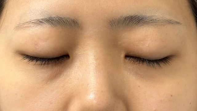 Preoperative Condition Part 1