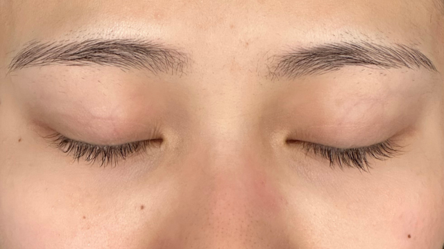 Preoperative Condition Part 1