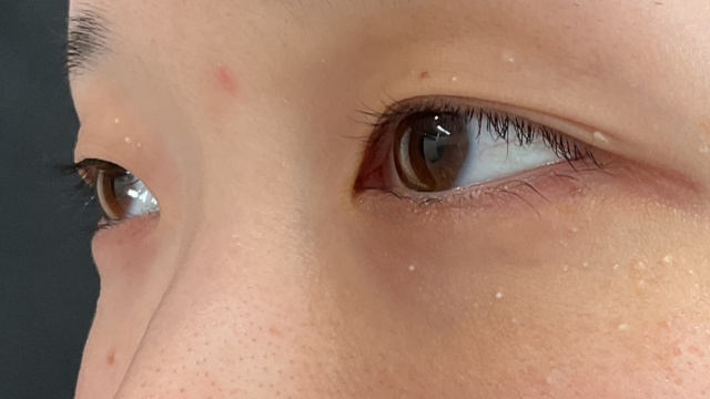 Preoperative Condition Part 1