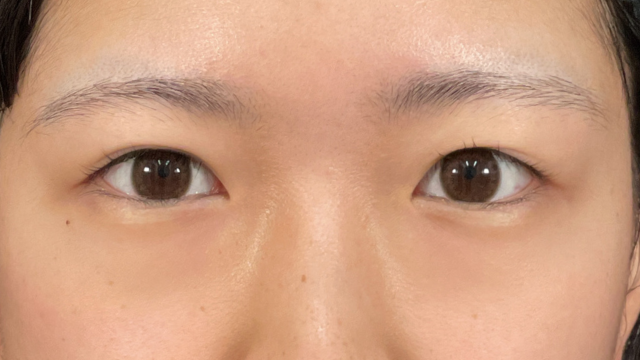 Preoperative Condition Part 1