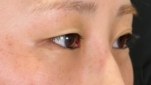 Preoperative Condition Part 1