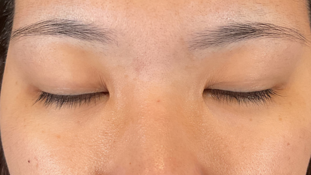 Preoperative Condition Part 1