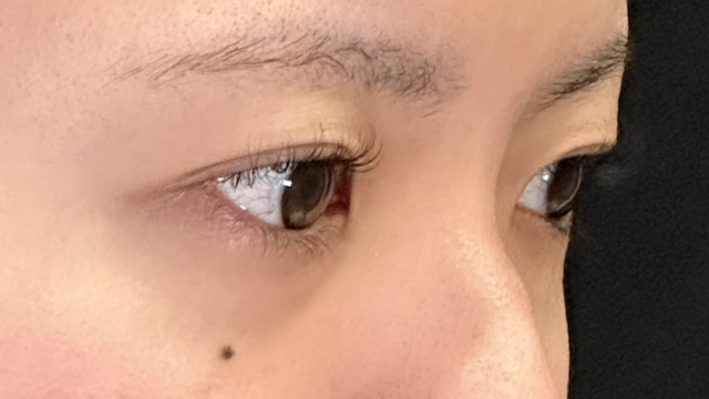 Preoperative Condition Part 1