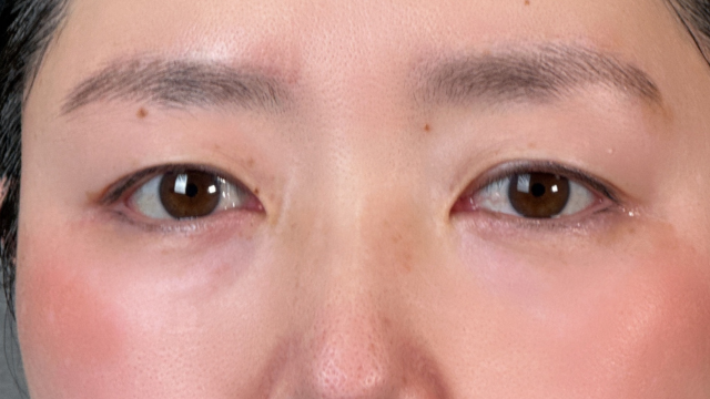 Preoperative Condition Part 1