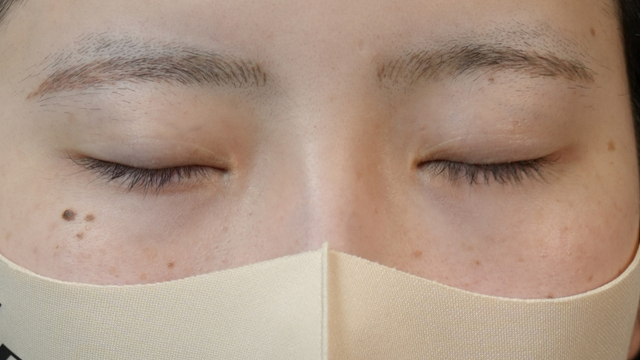 Preoperative Condition Part 1