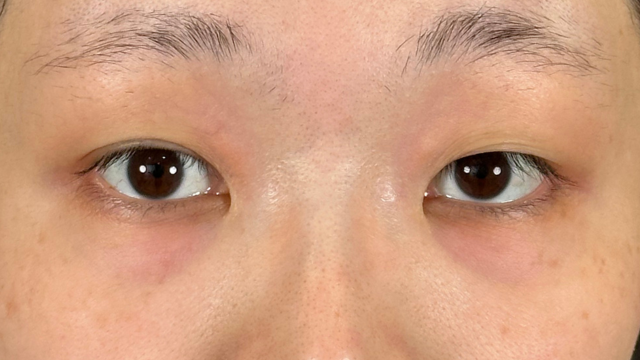 Preoperative Condition Part 1