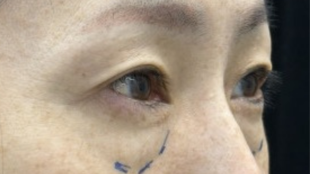 Preoperative Condition Part 1