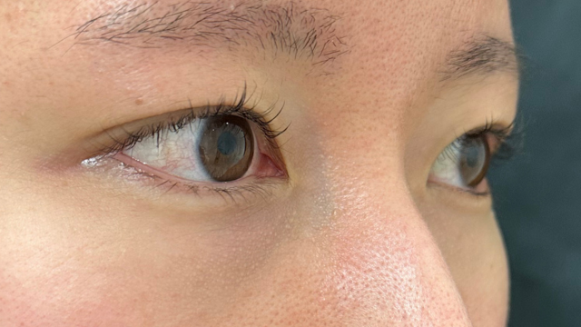 Preoperative Condition Part 1