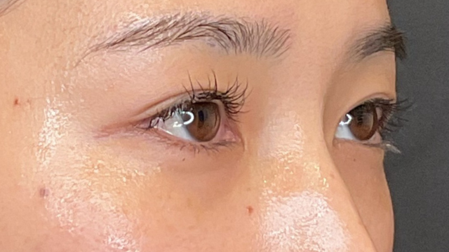 Preoperative Condition Part 1