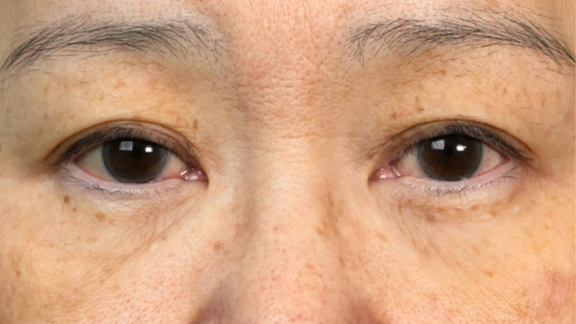 Preoperative Condition Part 1