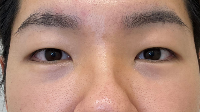 Preoperative Condition Part 1