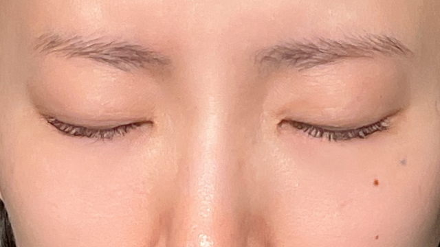 Preoperative Condition Part 1