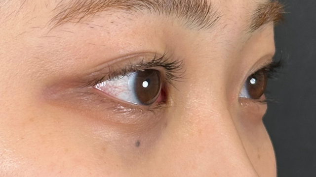 Preoperative Condition Part 1