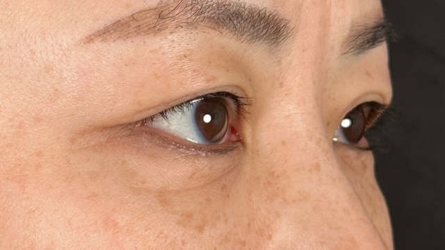 Preoperative Condition Part 1