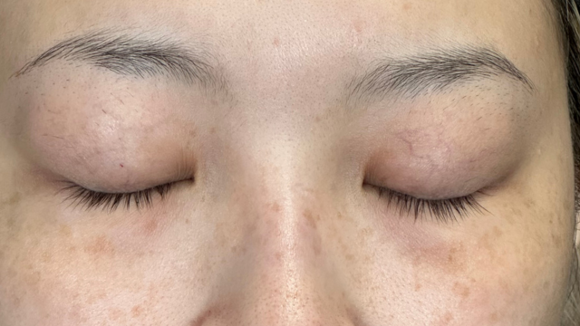 Preoperative Condition Part 1