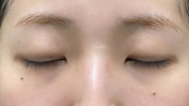 Preoperative Condition Part 1